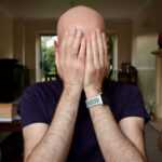 How Fast Does Male Pattern Baldness Progress? What to Expect