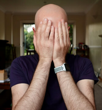 How Fast Does Male Pattern Baldness Progress? What to Expect