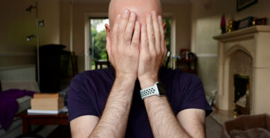 How Fast Does Male Pattern Baldness Progress? What to Expect