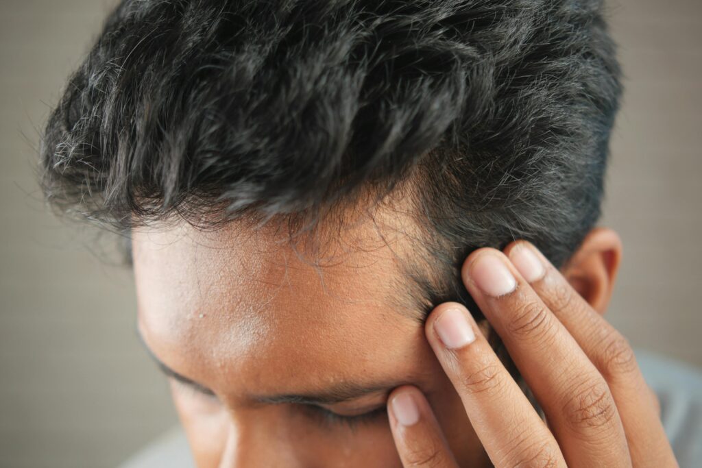 Does Wearing a Hat Cause Hair Loss ? The Real Answer