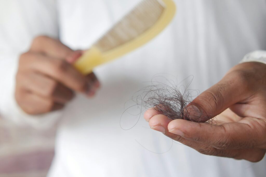 Why Is My Hair Thinning in My 20s ?