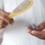 Why Is My Hair Thinning in My 20s ?